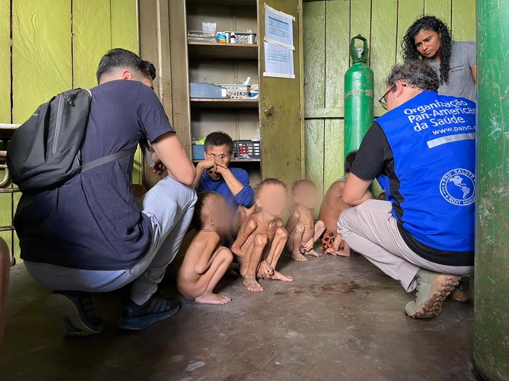 Crianças Yanomami com desnutrição severa são atendidos por equipes do Ministério da Saúde. Foto: Condisi-YY/Divulgação