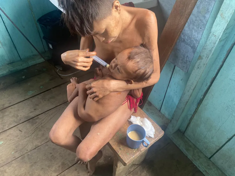 Crianças yanomami sofrem com desnutrição. Foto: Júnior Hekurari/Arquivo Pessoal